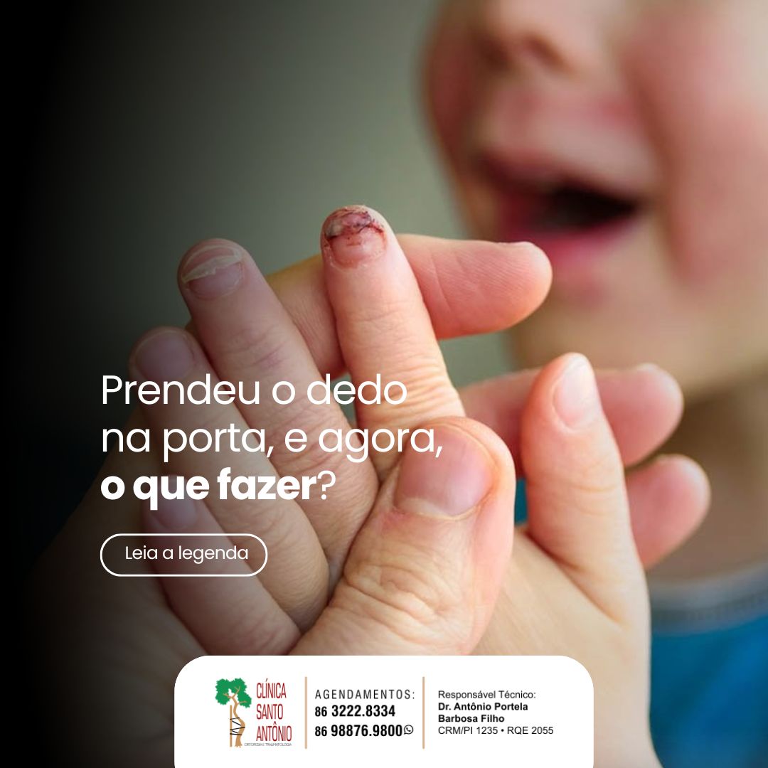 Leia mais sobre o artigo Prendeu o dedo na porta, e agora?