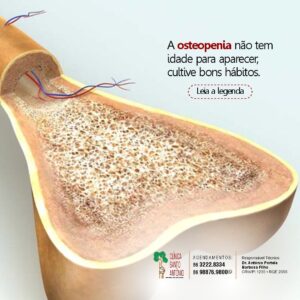 Leia mais sobre o artigo Osteopenia