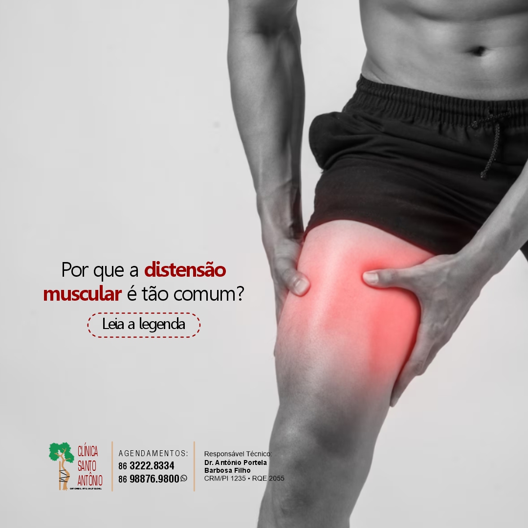 No momento, você está visualizando Por que a distensão muscular é tão comum?