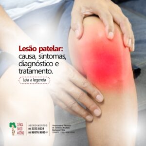 Leia mais sobre o artigo Lesão patelar