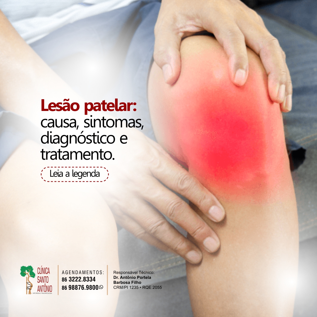 No momento, você está visualizando Lesão patelar