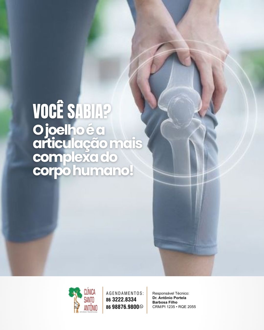 Leia mais sobre o artigo Você sabia? O joelho é a articulação mais complexa do corpo humano!