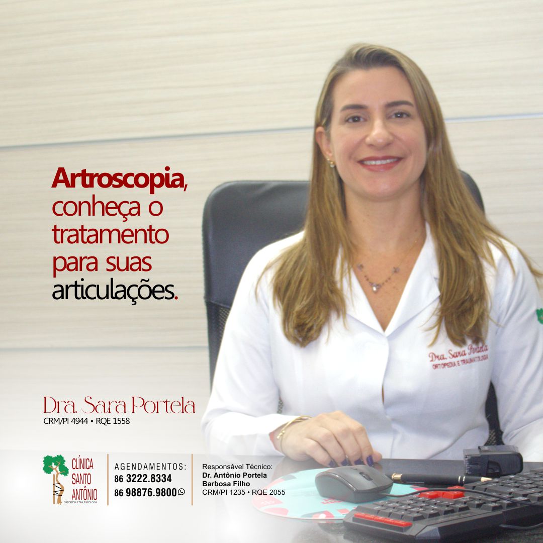 No momento, você está visualizando Artroscopia: conheça o tratamento para as suas articulações.