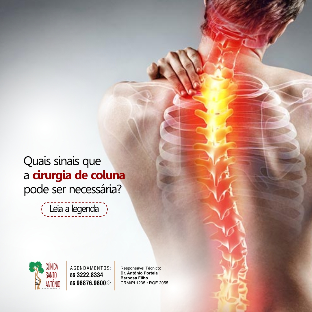 Leia mais sobre o artigo Quando a cirurgia de coluna é necessária?