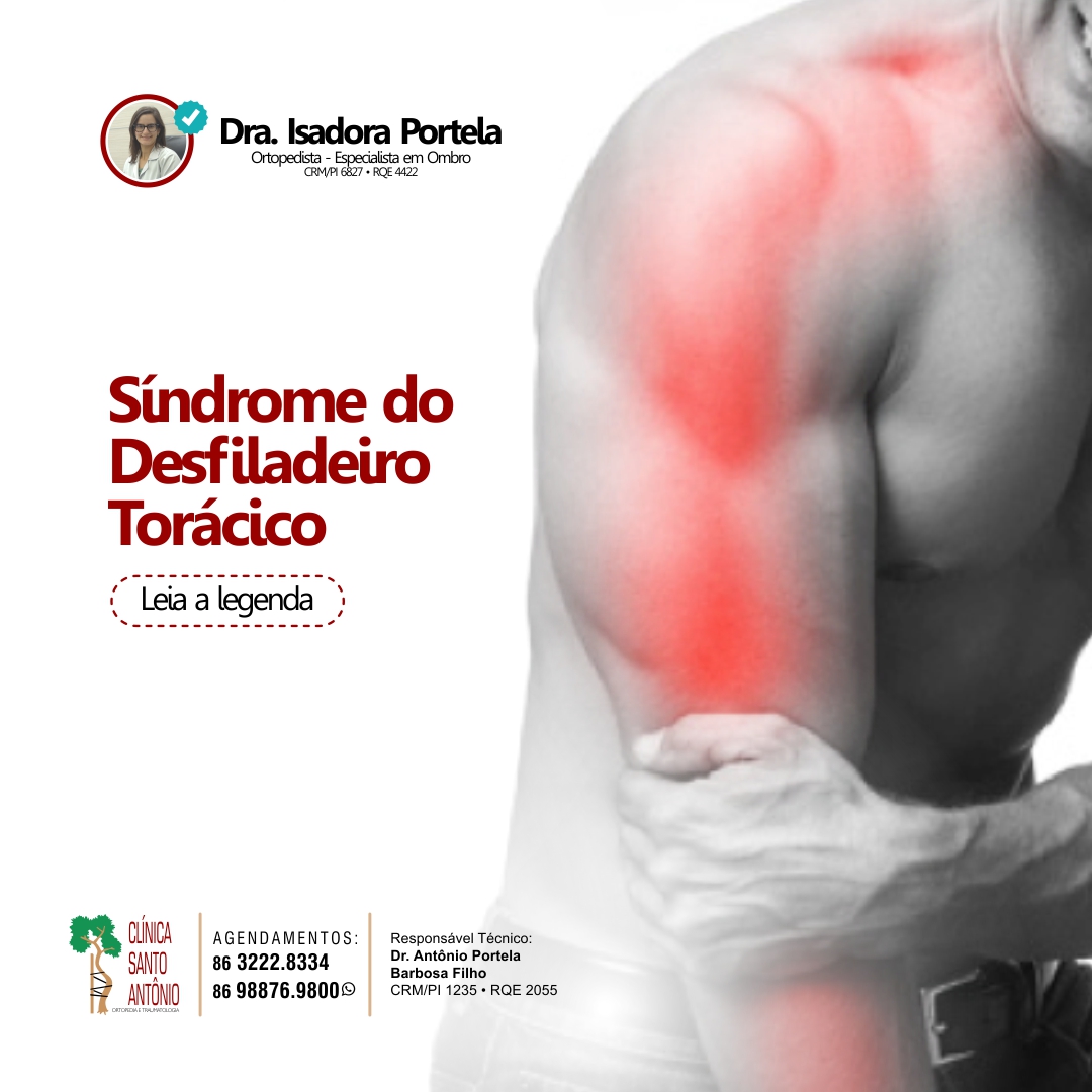 Leia mais sobre o artigo Síndrome do desfiladeiro torácico