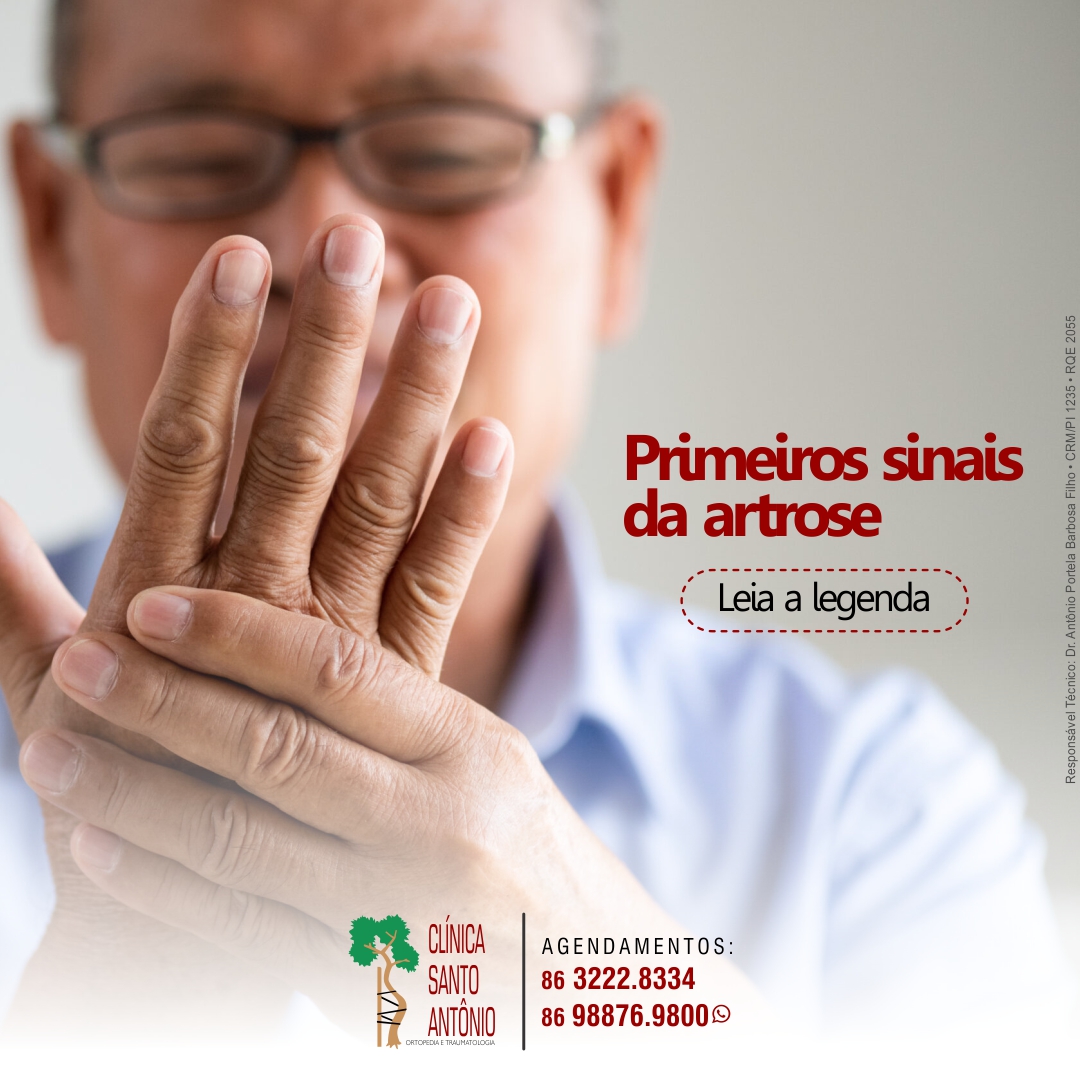 Leia mais sobre o artigo Primeiros sinais da artrose