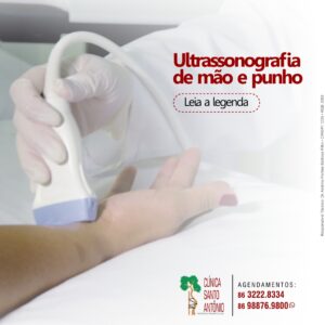 Leia mais sobre o artigo Ultrassonografia de mão e punho