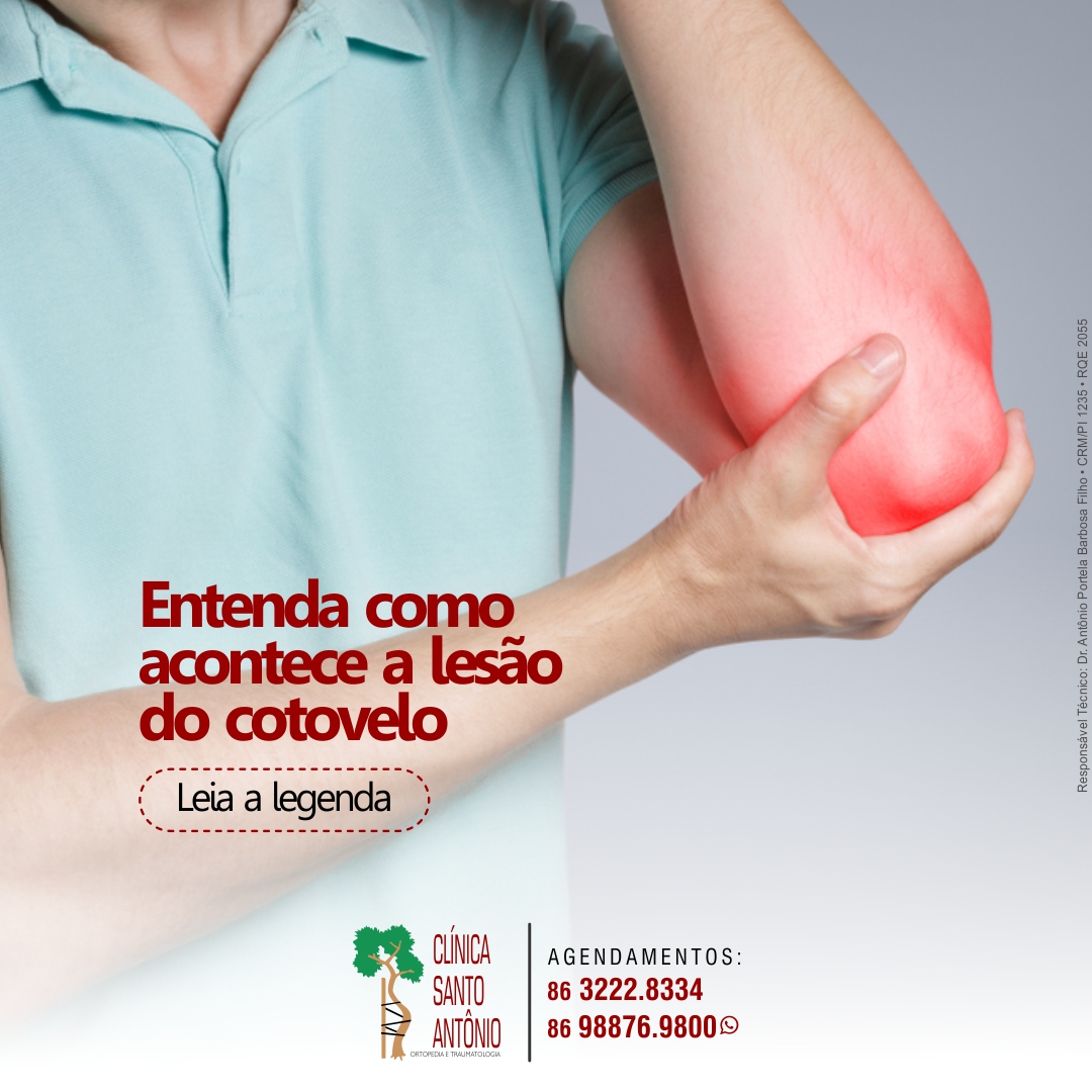 Leia mais sobre o artigo Entenda como acontece a lesão no cotovelo.