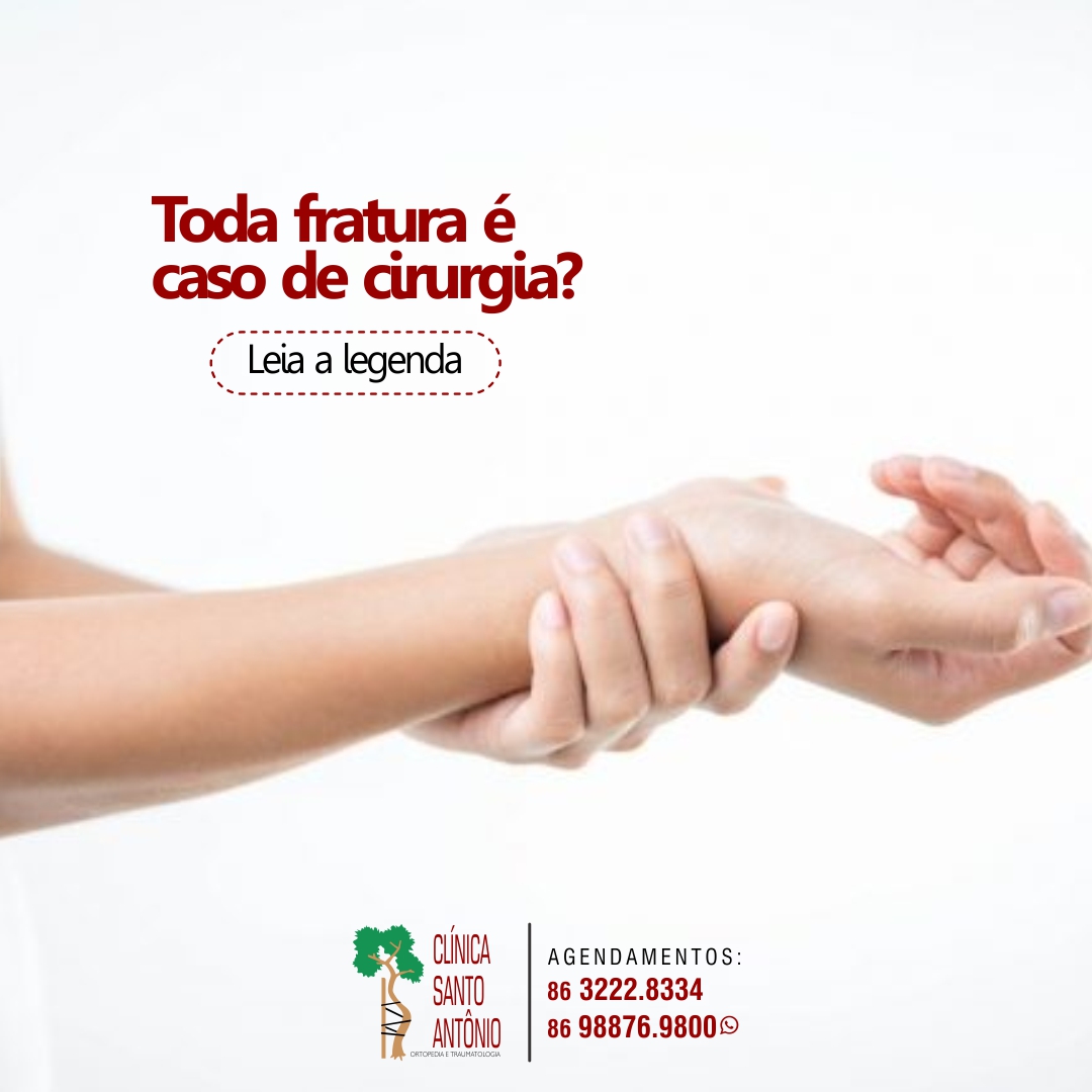 Leia mais sobre o artigo Toda fratura é caso de cirurgia?