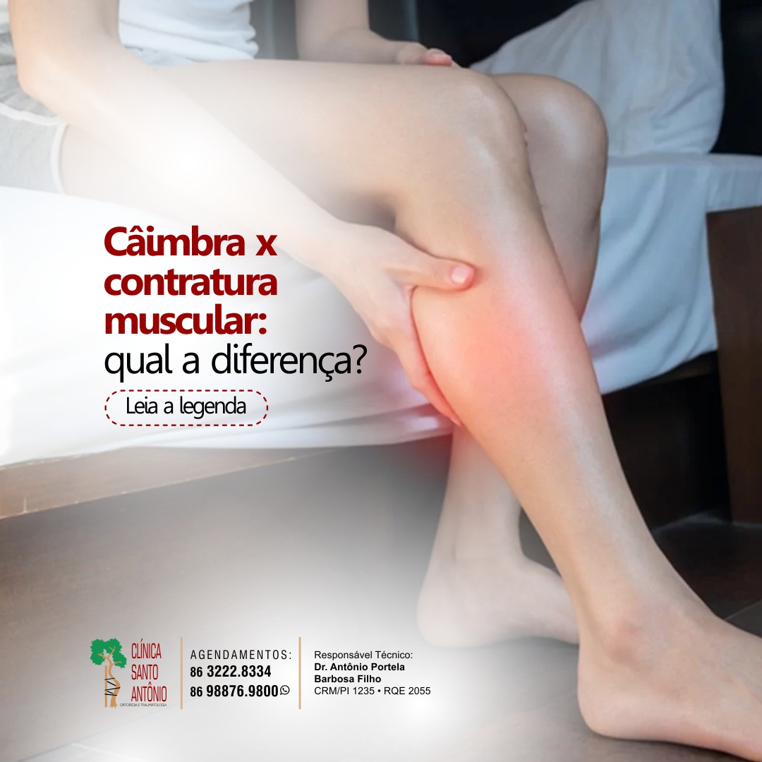 Leia mais sobre o artigo Câimbra x contratura muscular