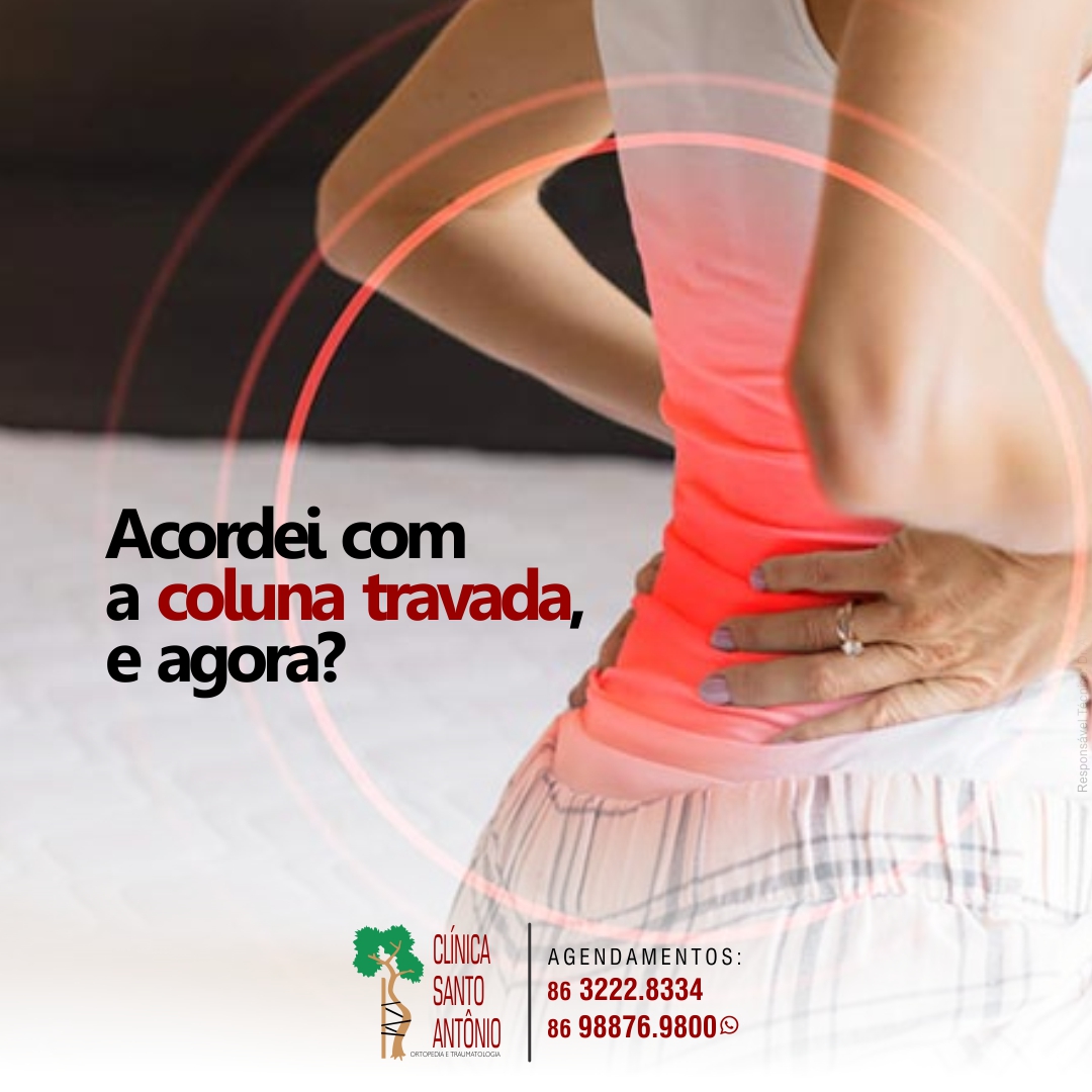 Leia mais sobre o artigo Acordei com a coluna travada, e agora?