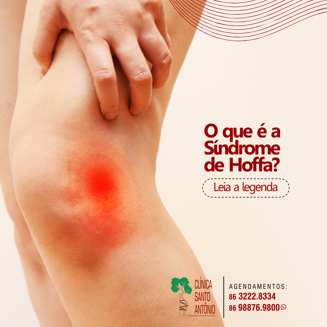 Leia mais sobre o artigo Você já ouviu falar da Síndrome de Hoffa?