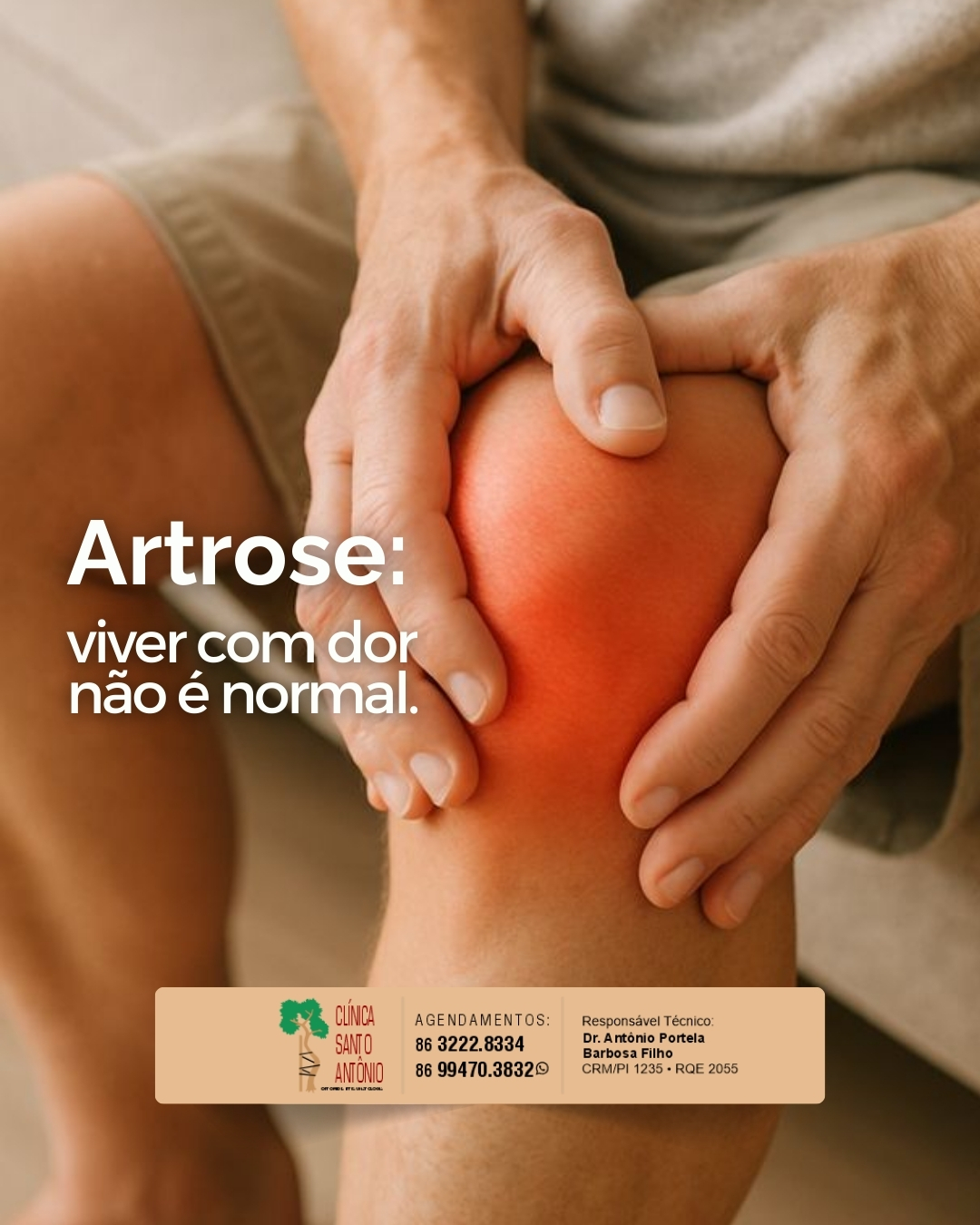 Leia mais sobre o artigo Artrose: viver com dor não é normal.