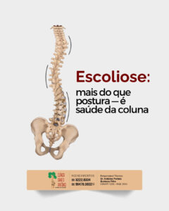Leia mais sobre o artigo Escoliose