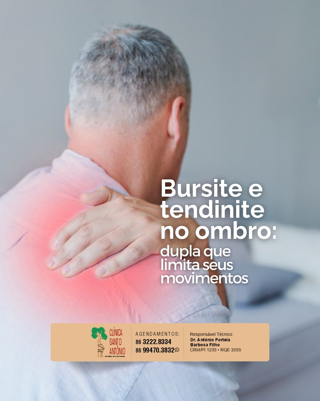 Leia mais sobre o artigo Bursite e tendinite no ombro: dupla que limita seus movimentos