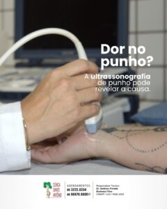 Leia mais sobre o artigo Ultrassonografia do punho: quando é indicado realizá-la?