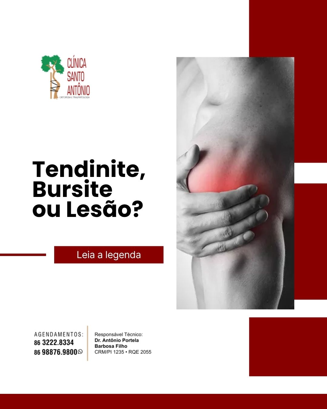 Leia mais sobre o artigo Tendinite, bursite ou lesão?