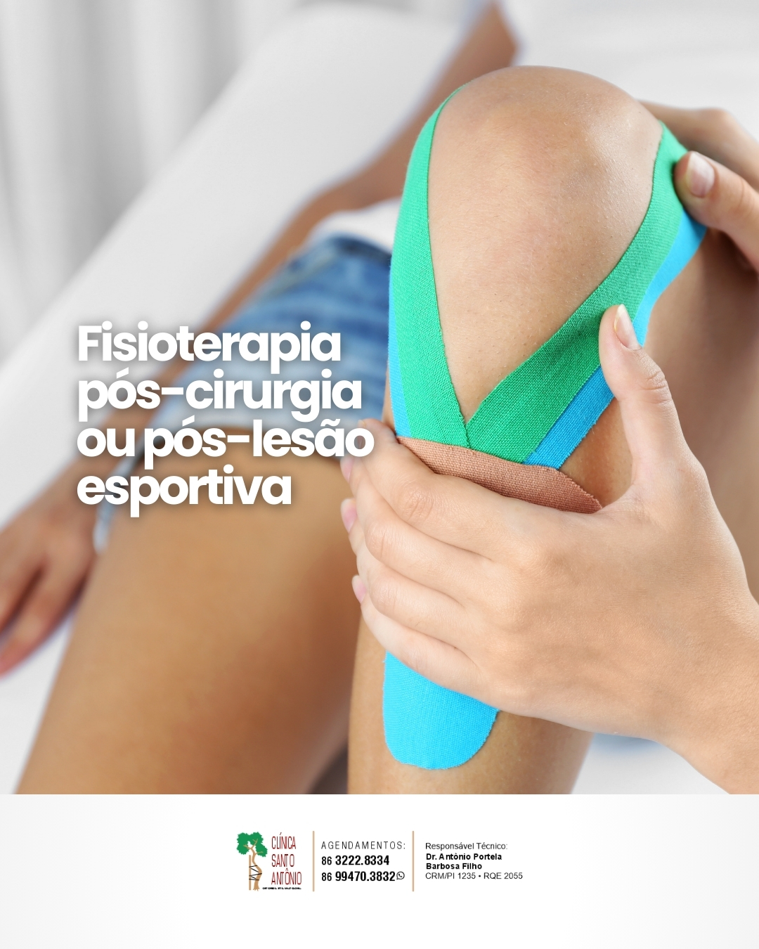 Leia mais sobre o artigo Fisioterapia pós-cirurgia – pós-lesão esportiva