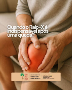 Leia mais sobre o artigo Quando o Raio-X é indispensável após uma queda?