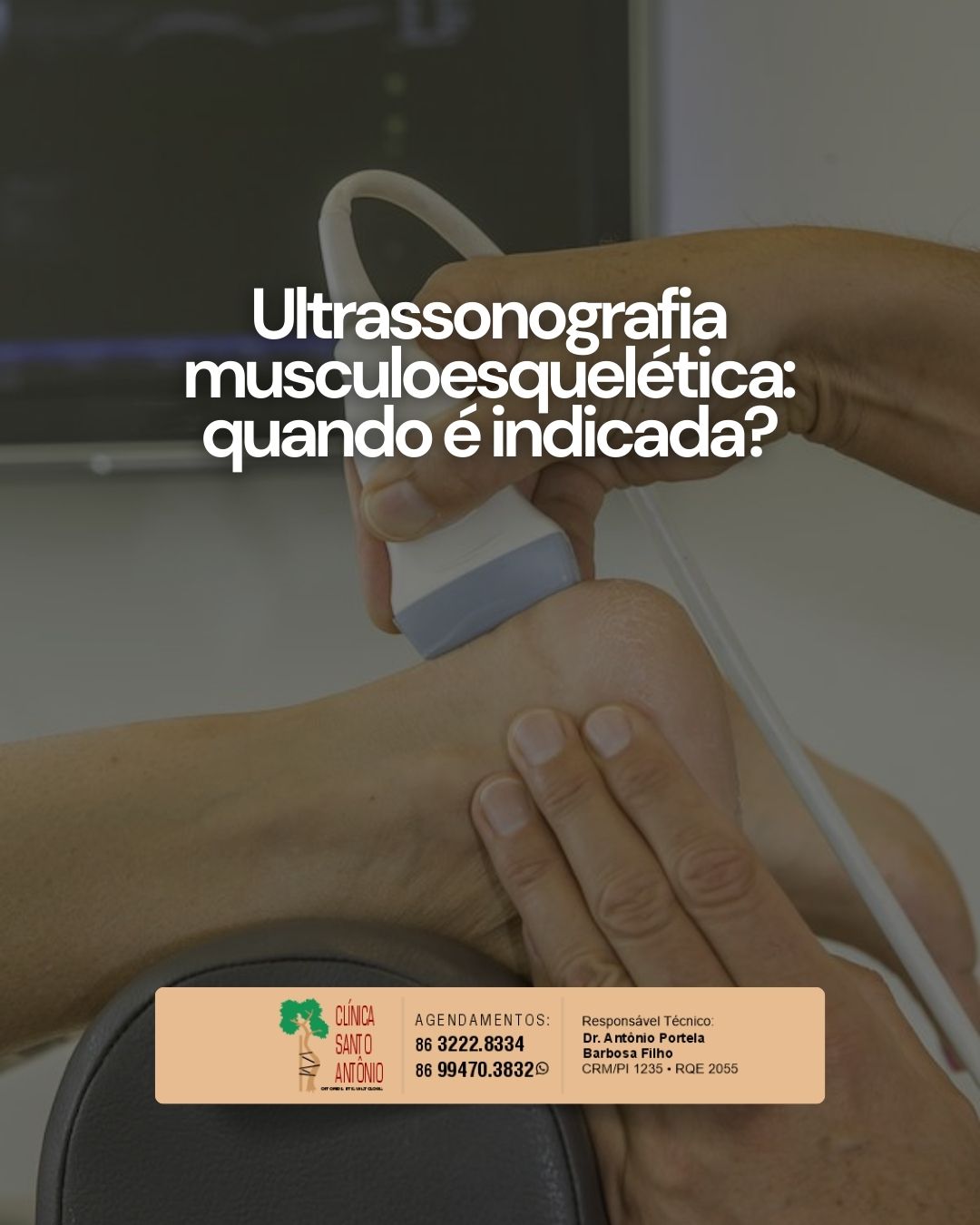 Leia mais sobre o artigo Ultrassonografia musculoesquelética: quando é indicada?