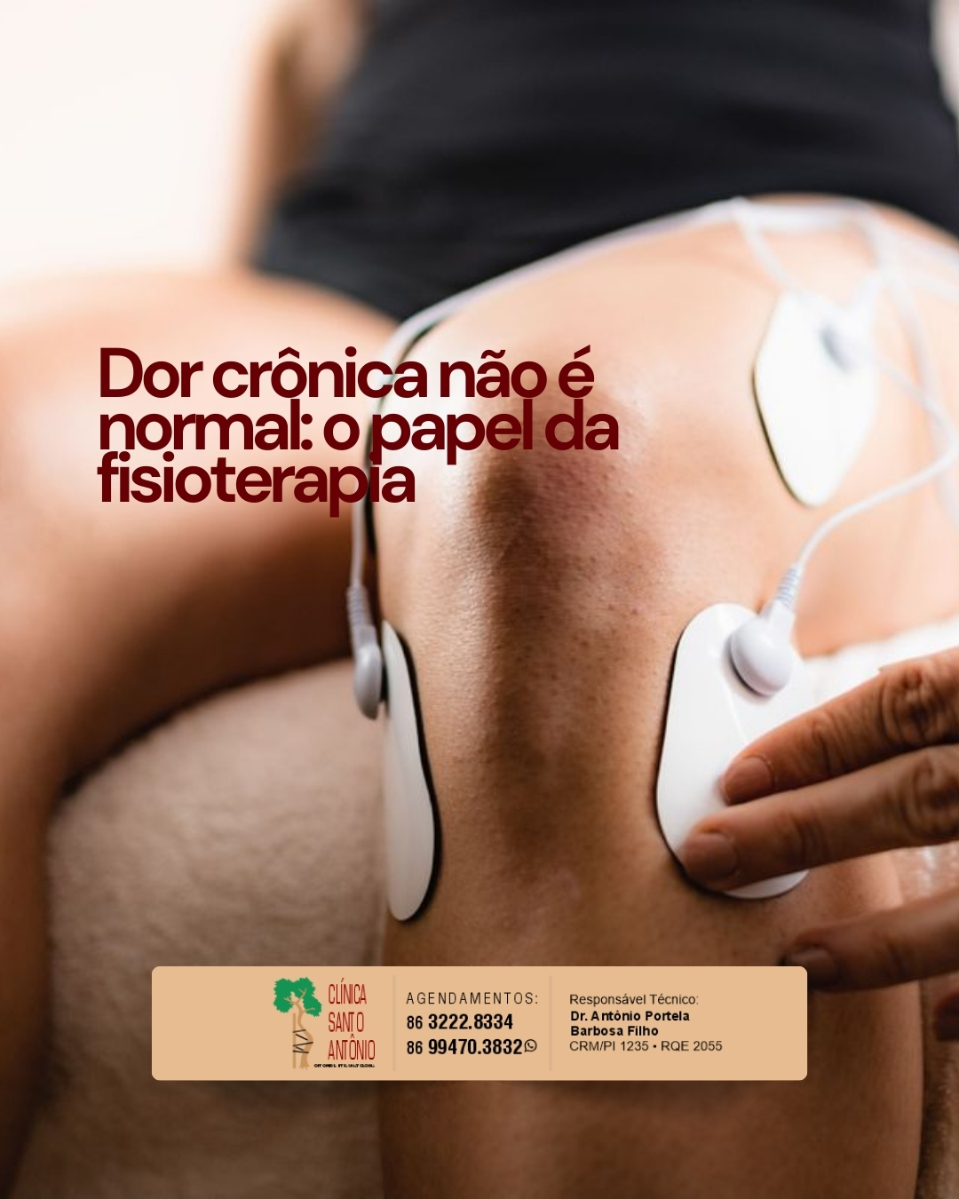 Leia mais sobre o artigo Dor crônica não é normal: o papel da fisioterapia