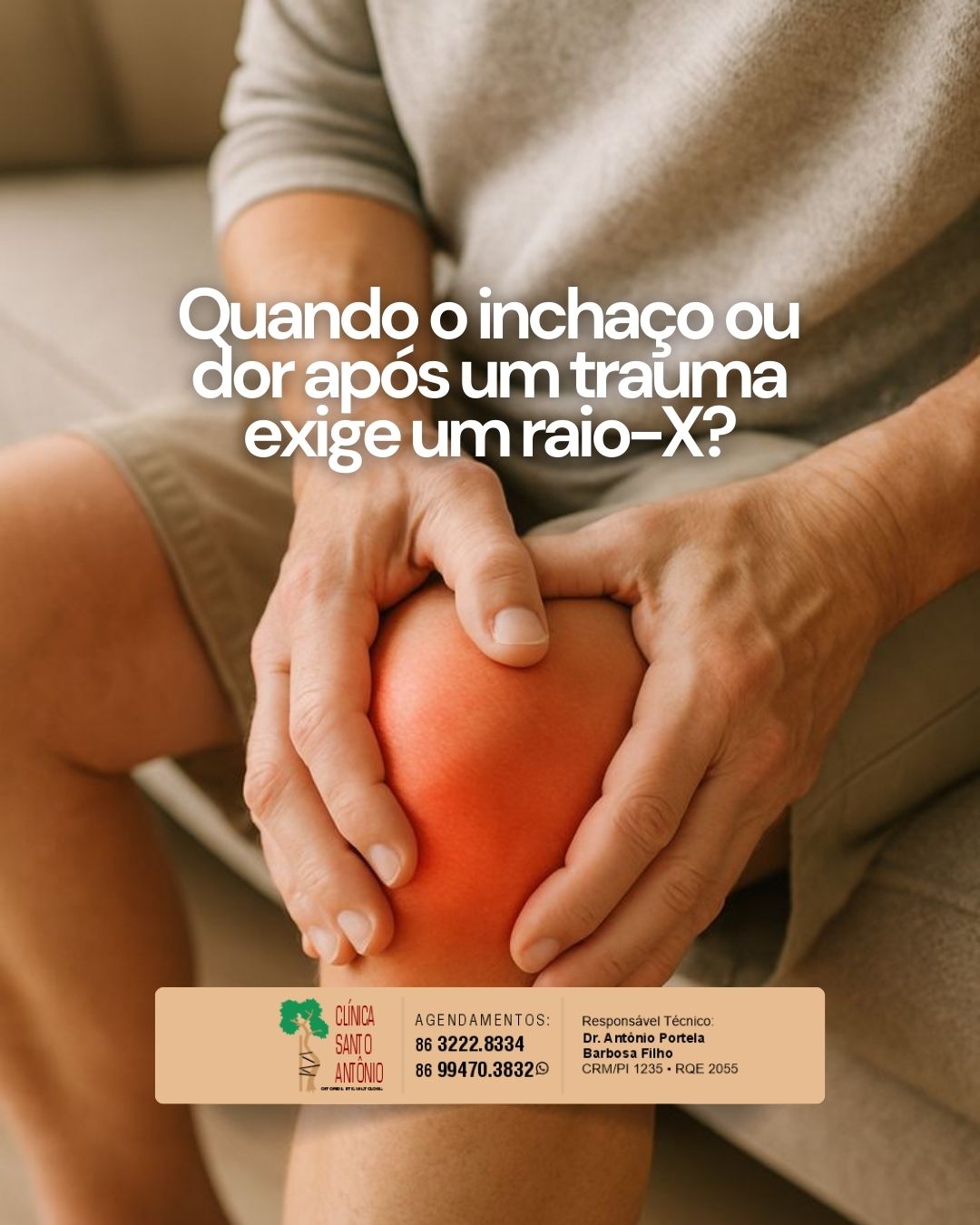 Leia mais sobre o artigo Quando o inchaço ou dor após um trauma exige um raio-X?