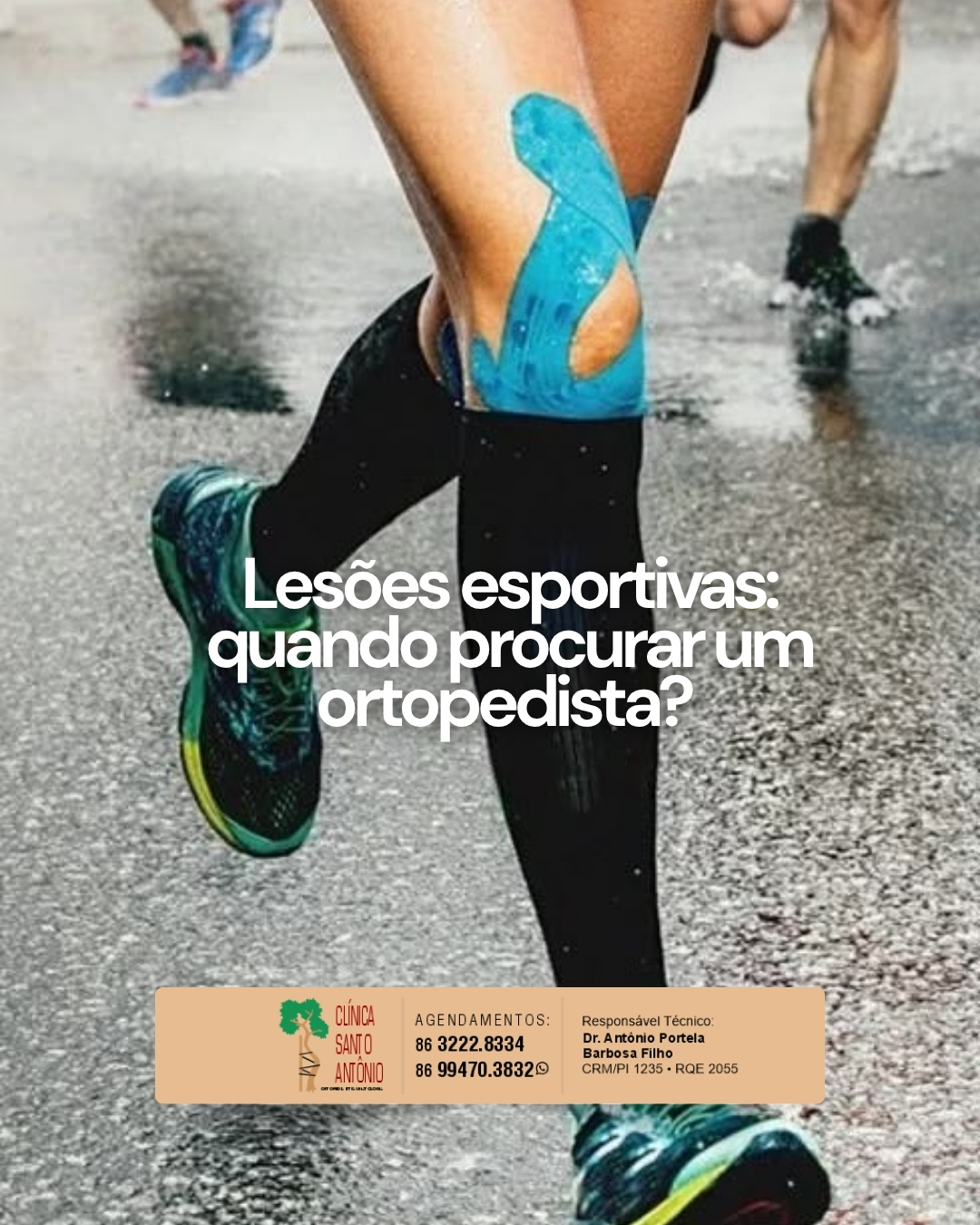 Leia mais sobre o artigo Lesões esportivas