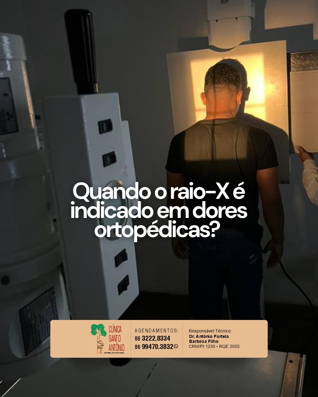 Leia mais sobre o artigo Quanso o raio-x é indicado.