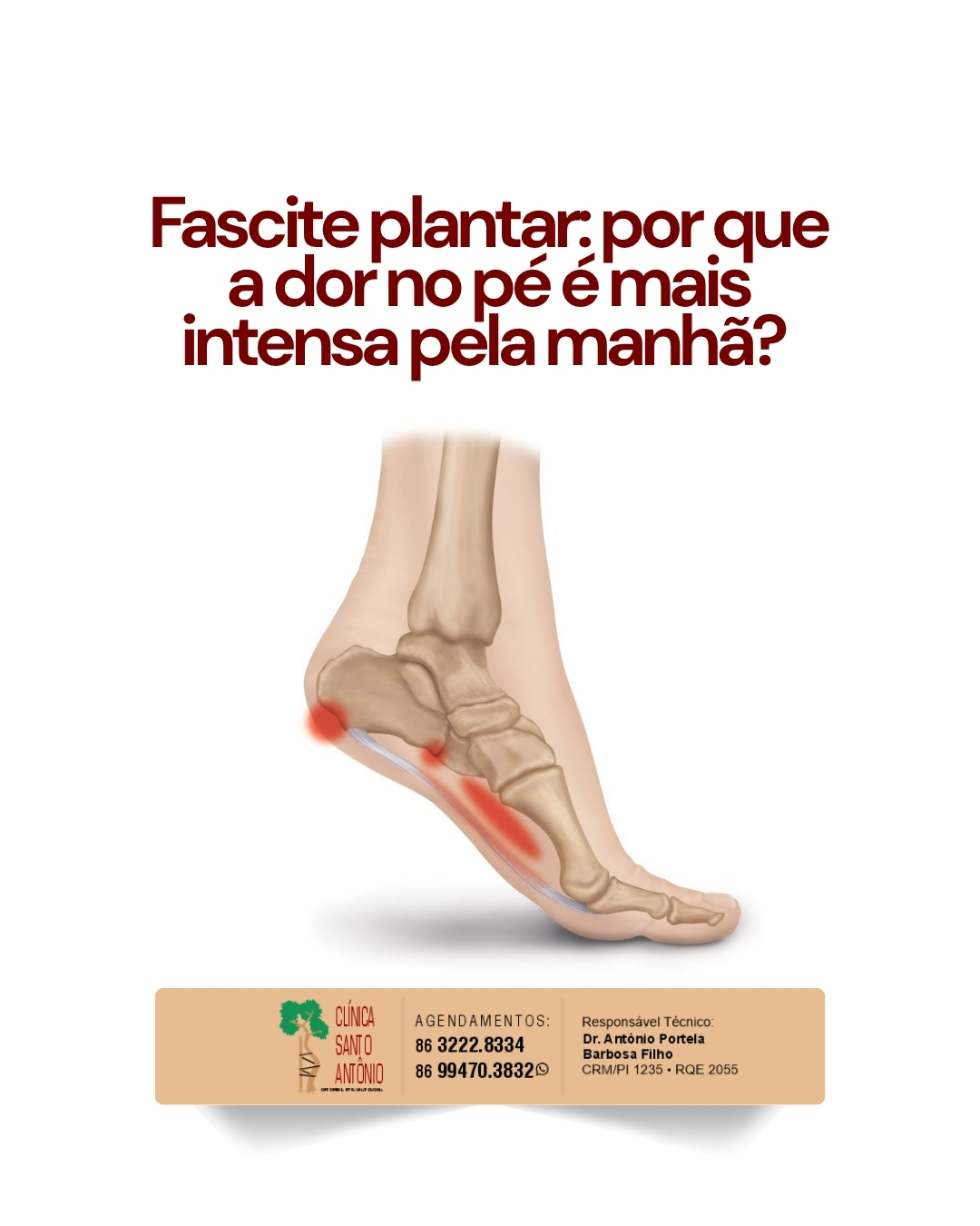 Leia mais sobre o artigo Fascite plantar